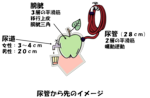 尿管.png